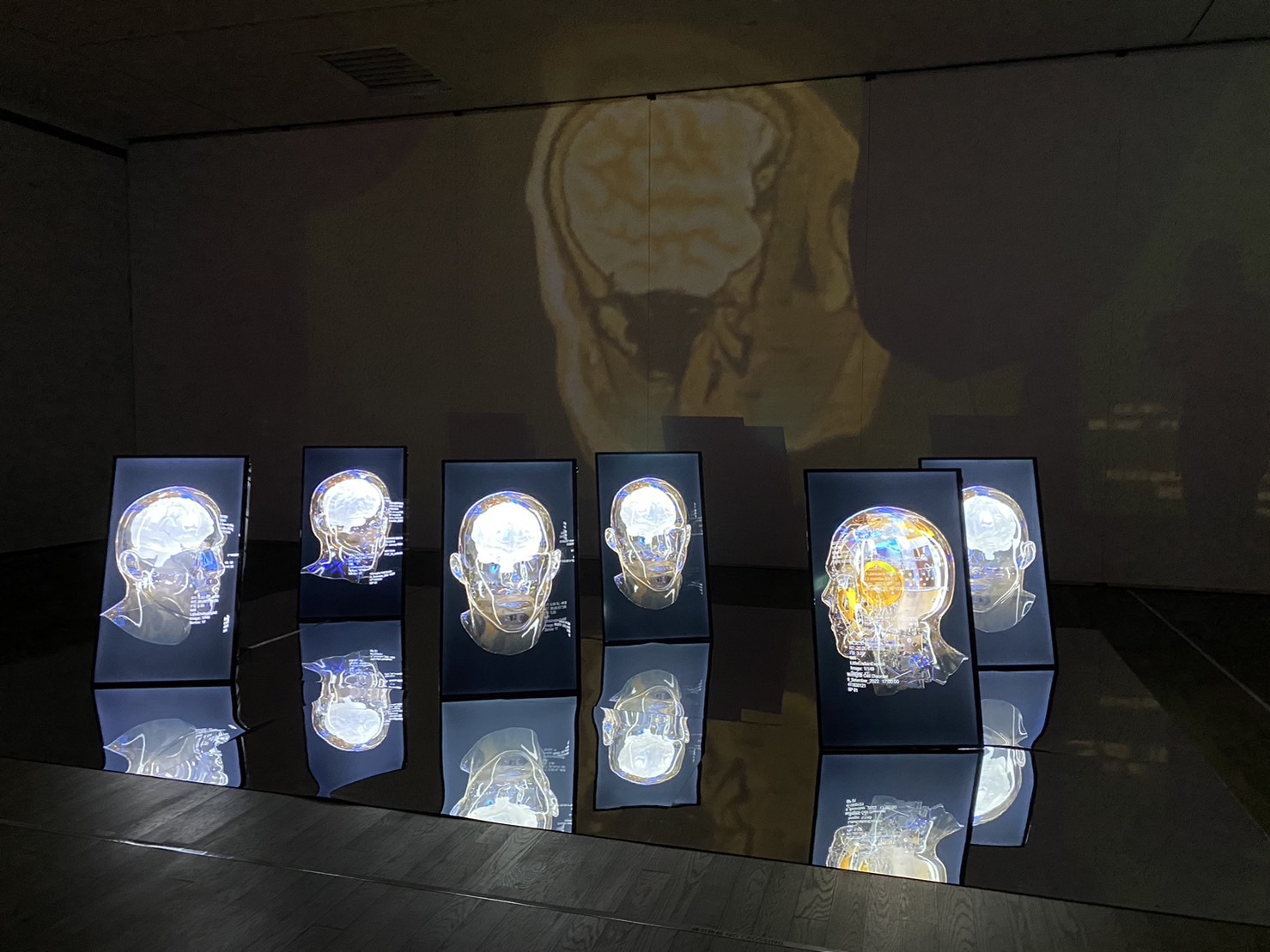 微膠細胞失序-林月霞個展 展場照